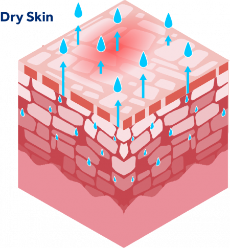 Dry skin